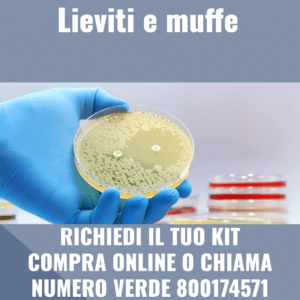 Lieviti e muffe