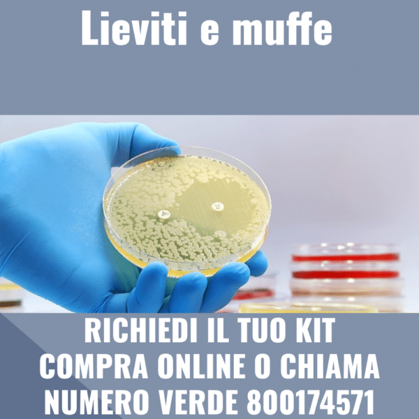 Lieviti e muffe