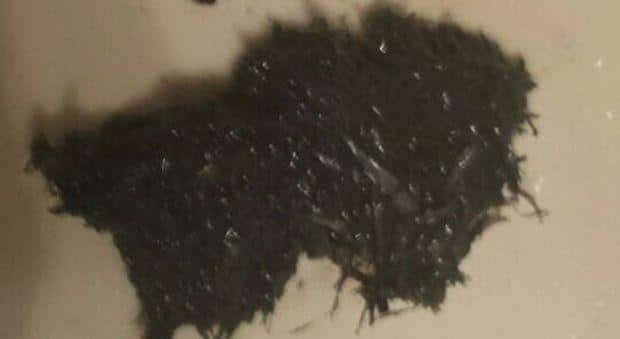 Melma Nera nel Lavandino: Come Risolvere il Problema