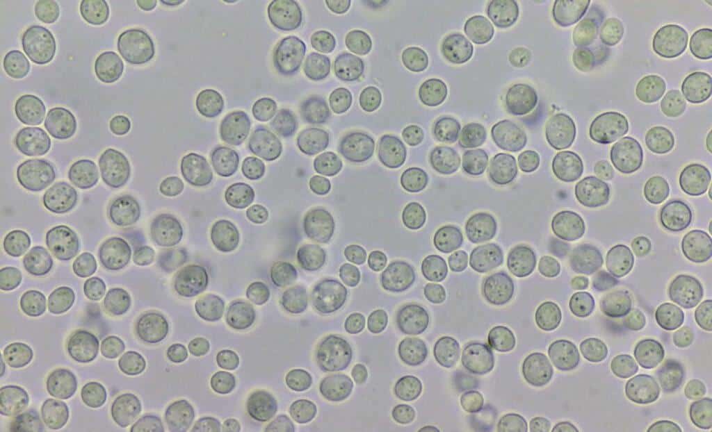 Lieviti in Microbiologia: Importanza e Metodi di Studio